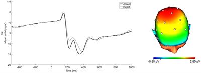 Blunted Social Reward Responsiveness Moderates the Effect of Lifetime Social Stress Exposure on Depressive Symptoms